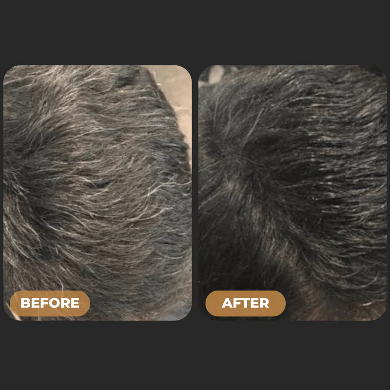 VALOR™ - Gray Hair Reverse Bar